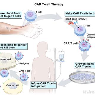 CAR T-cell therapy