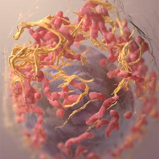 3D structure of a melanoma cell