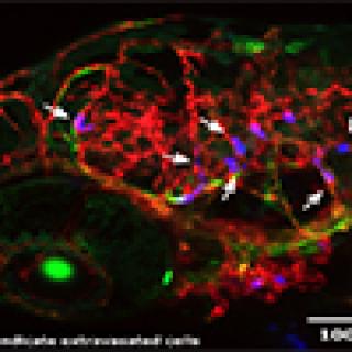 Human breast tumor cells arrested in the blood vessels of zebrafish larvae