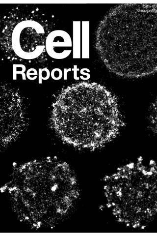 Clustering of BCR maps dysfunctional signaling in Chronic Lymphocytic Leukemia