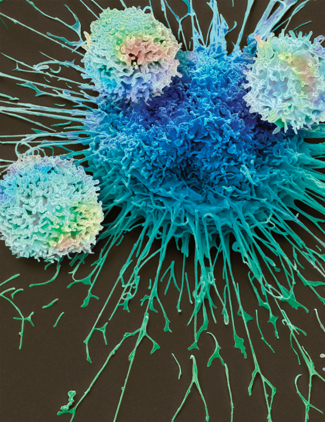 CAR T Cells for Solid Tumors | Center for Cancer Research