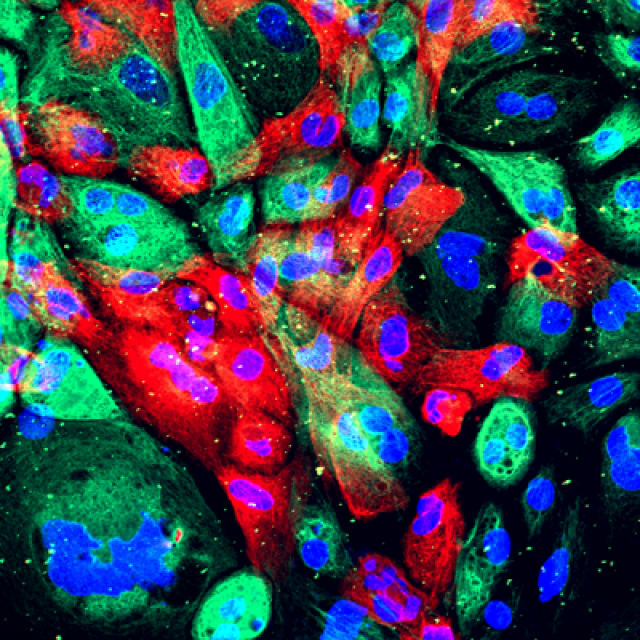 wild-type human prostate cells from an organoid