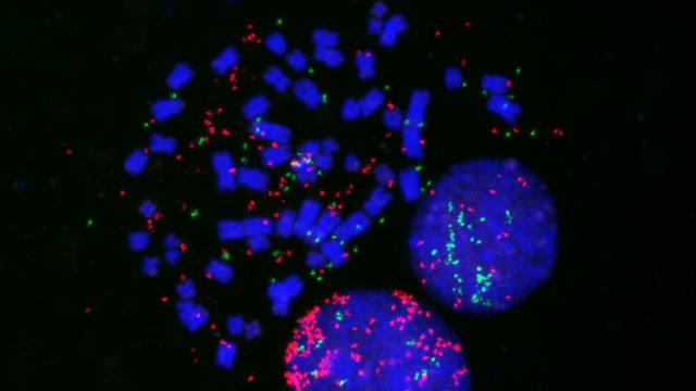Lung cancer cells fluorescently labeled for MYC (red), MYCL (green) and chromosomes (blue) to identify MYC- and MYCL-positive ecDNA in the cells.