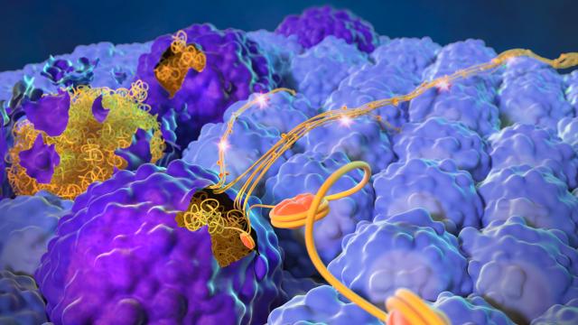 Cancer cells that die via apoptosis (larger dark purple structures) expel their nuclear contents (orange and yellow stringy structures) to spur metastasis and growth of living cancer cells (smaller light blue structures). Image credit: Yang Lab