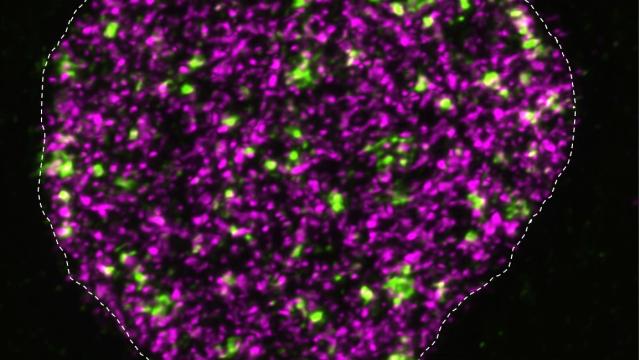 DNA breakage and synthesis in the cell nucleus