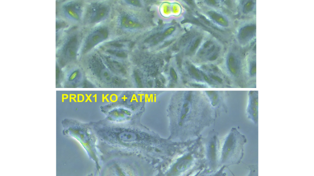 non-small lung cancer cells