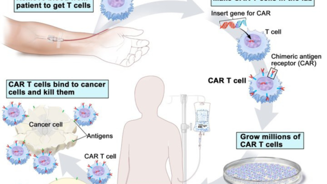 Kreitman trial CAR T cell therapy description