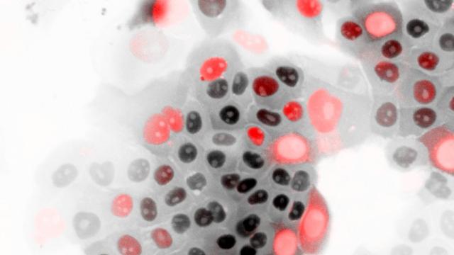 Cells showing the biosensor used in this study to test the activity of APC/C