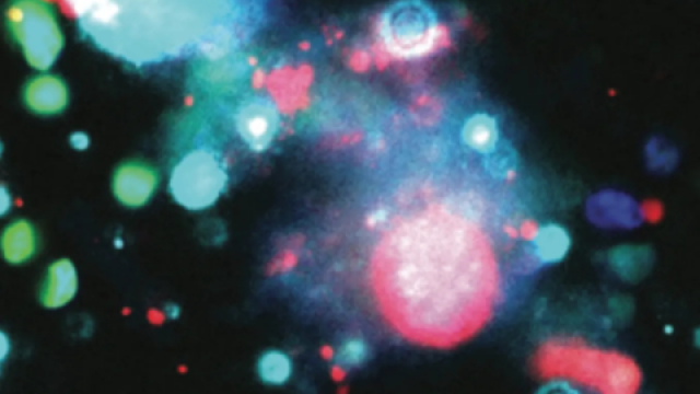 Immunofluorescence image of the cell adhesion protein basigin (turquoise) in TuNEPs released from dying 4T1 mouse breast cancer cells. 