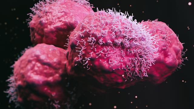 Tumor cells