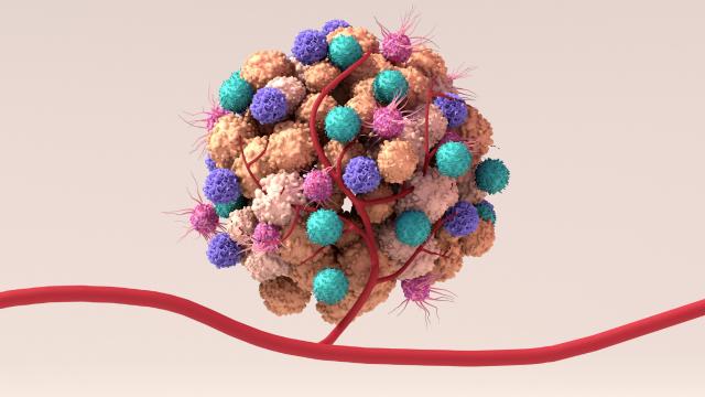 artist depiction of a tumor microenvironment