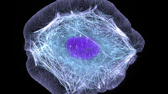 human skin cell treated with a growth factor that enabled the cell to move