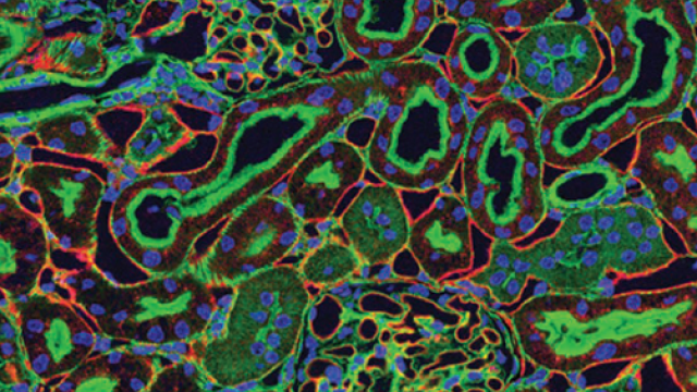 stained kidney tissue