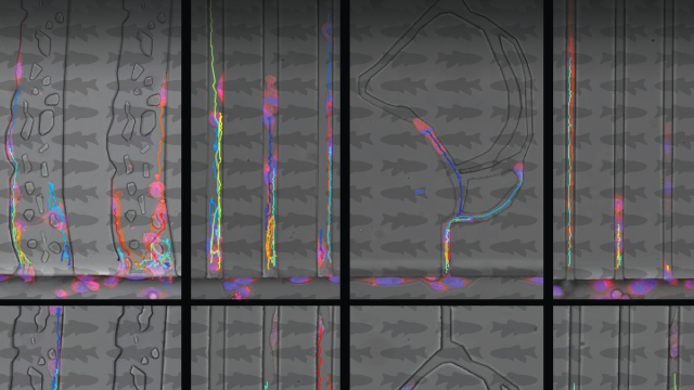 Tracking Cancer Cells in Transparent Fish