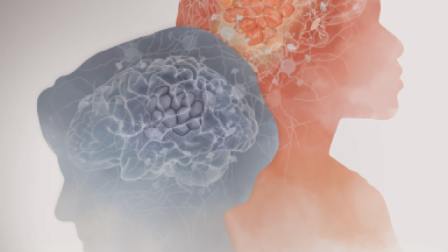 Why Age is an Advantage - Illustration of an older woman's head (left) and a younger woman's head (right) showing various states of metastasis in each brain