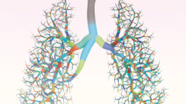Divide and Conquer - Image of lungs with branches representing the genetic variations only recently found in different patients with small cell lung cancer