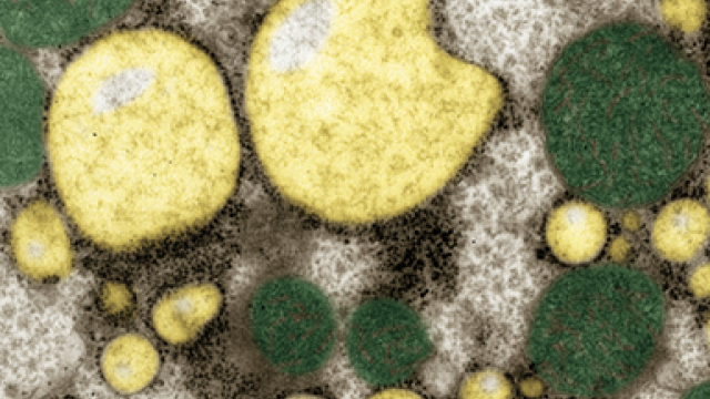 Help for a Fatty Liver