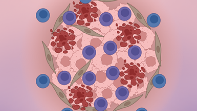 An Unexpected Cancer Killer