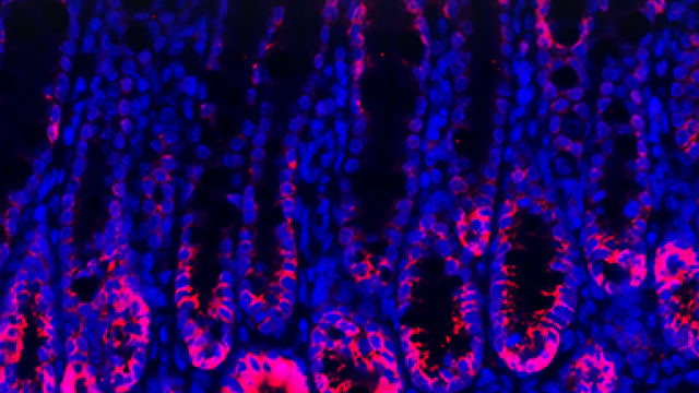 This image depicts intestinal tissues stained for PEDF protein (pink) from healthy mice.