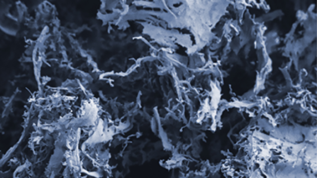 A biocompatible, porous and degradable scaffolding –– seen here imaged with a scanning electron microscope –– using the cell-free extracellular matrix of small intestine tissue. 