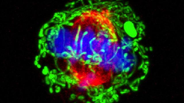 Cell division in breast cancer