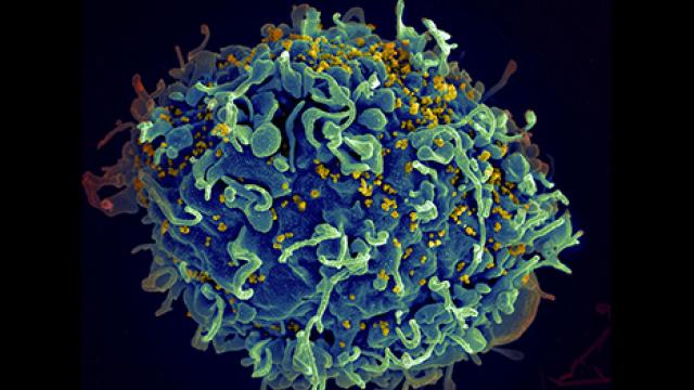 Human T cell (blue) is under attack by HIV (yellow)