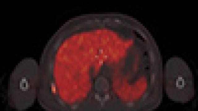 Prostate imaging