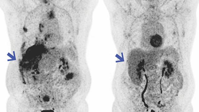 Patient scan