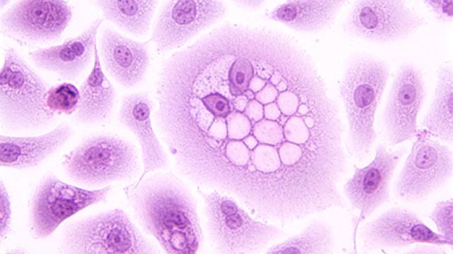 HPV oncogene