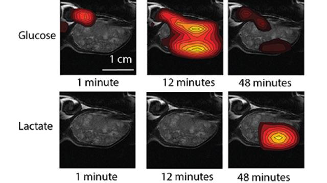 Contour maps created from glucose and lactate signals