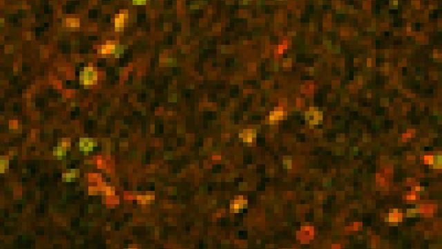 Immunotherapy cells