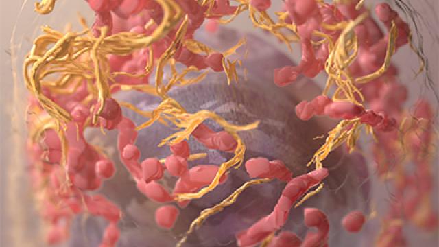 3D structure of a melanoma cell