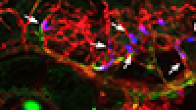 Human breast tumor cells arrested in the blood vessels of zebrafish larvae