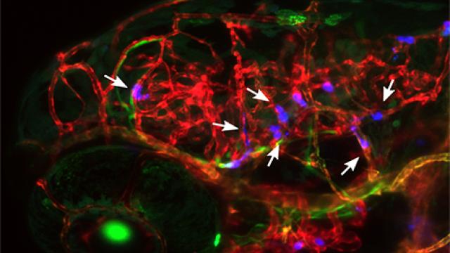 Human breast tumor cells arrested in the blood vessels of zebrafish larvae