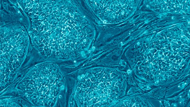 Human embryonic stem cells