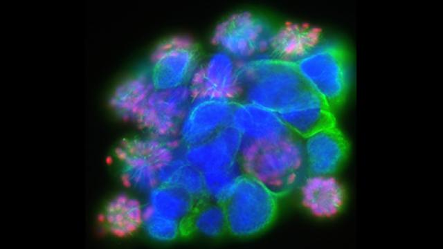 Patient-derived glioma stem cells 