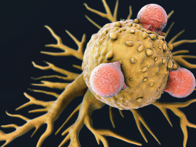 Scanning electron micrograph of T lymphocyte cells attached to a cancer cell.