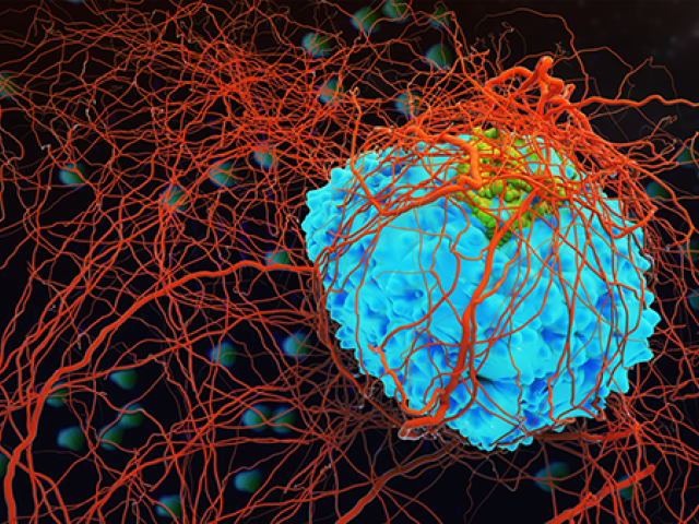 A 3D illustration of a cancer cell
