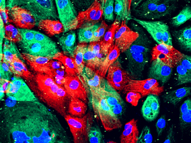 wild-type human prostate cells from an organoid