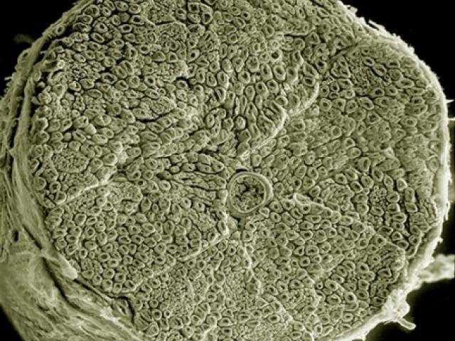 A scanning electron micrograph of a section through a human spinal nerve.