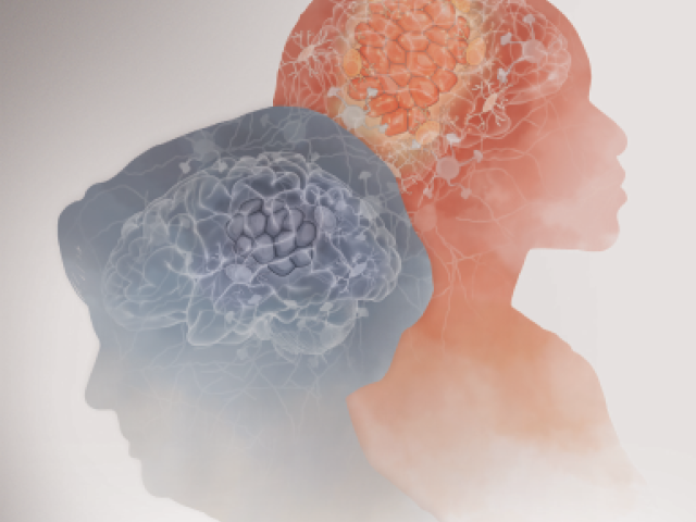 Why Age is an Advantage - Illustration of an older woman's head (left) and a younger woman's head (right) showing various states of metastasis in each brain
