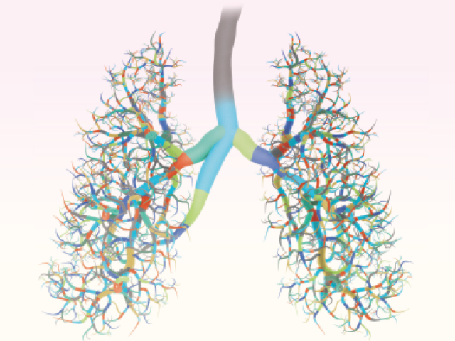 Divide and Conquer - Image of lungs with branches representing the genetic variations only recently found in different patients with small cell lung cancer