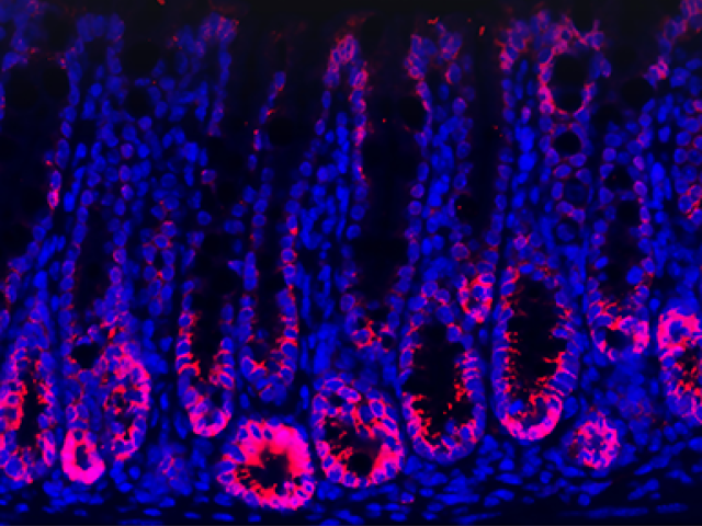 This image depicts intestinal tissues stained for PEDF protein (pink) from healthy mice.