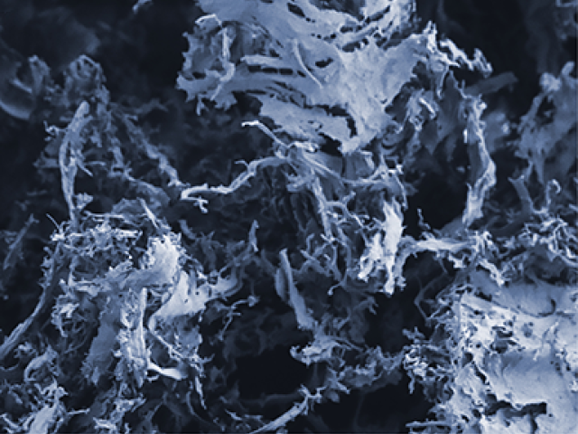 A biocompatible, porous and degradable scaffolding –– seen here imaged with a scanning electron microscope –– using the cell-free extracellular matrix of small intestine tissue. 