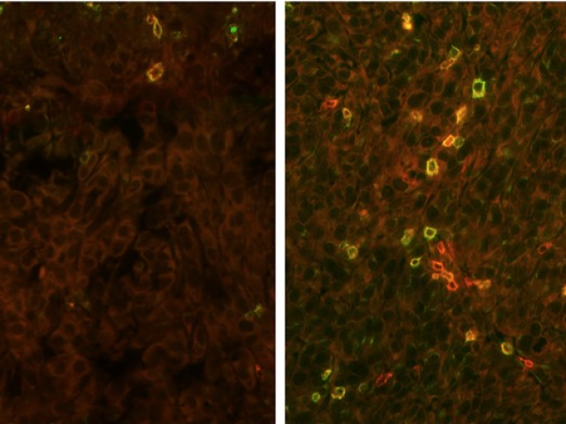 Immunotherapy cells