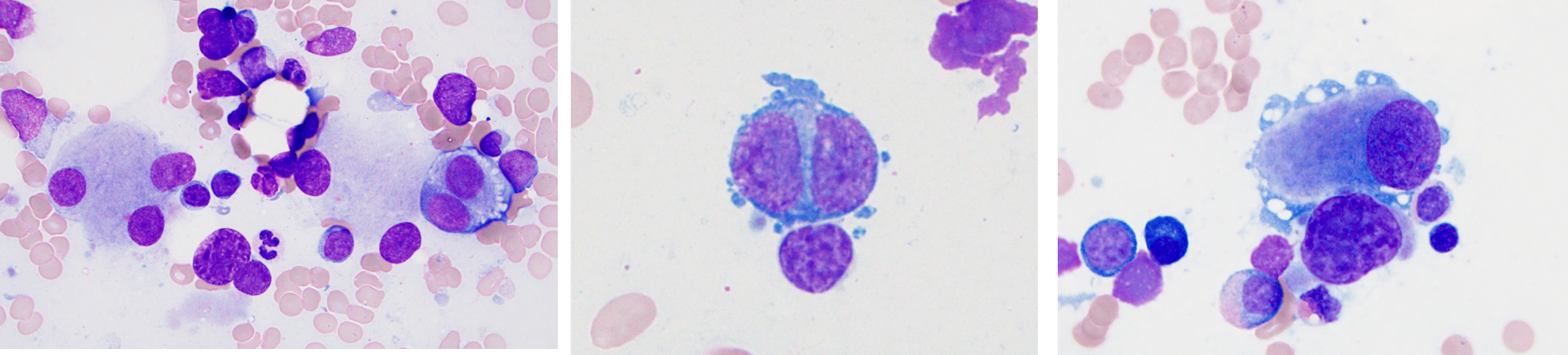 three images of myeloid cells
