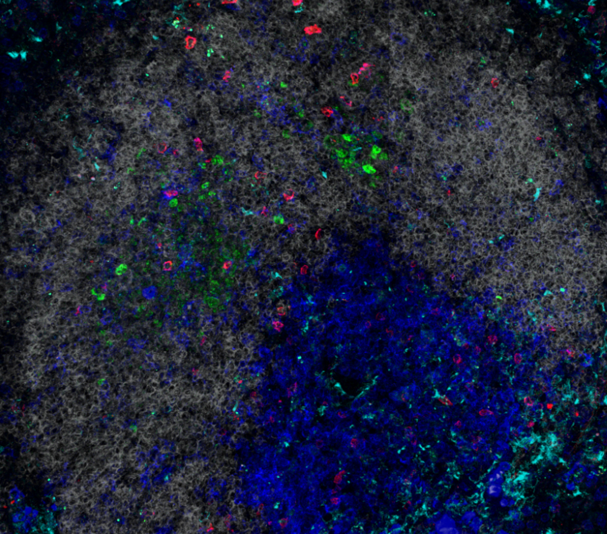 Immune cells in lymphoid tissue. Credit: Dr. Watanabe