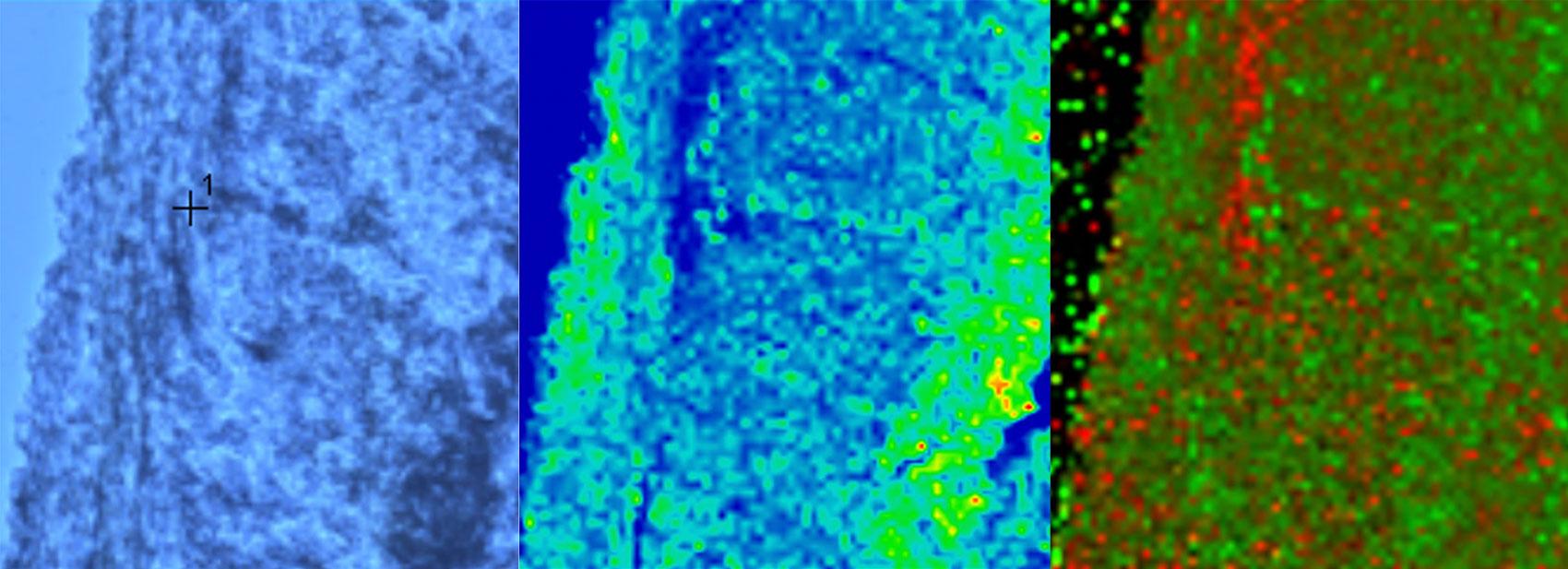 Three microscopy images of brain tissue