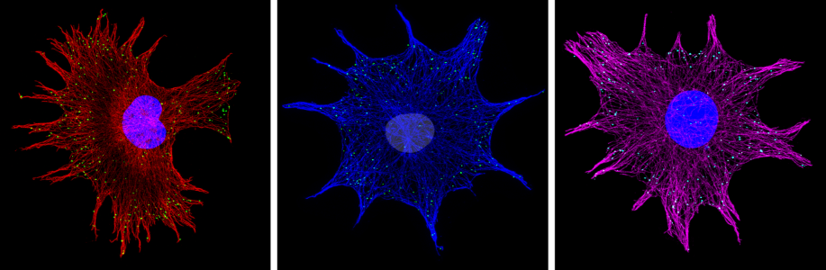 RNAs - microtubules in cells