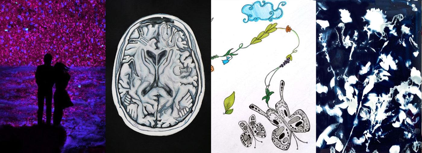 4 pieces of artwork: one showing people embracing, one showing a brain MRI scan, one showing a cyanotype of flowers, and one showing a drawing of a butterfly